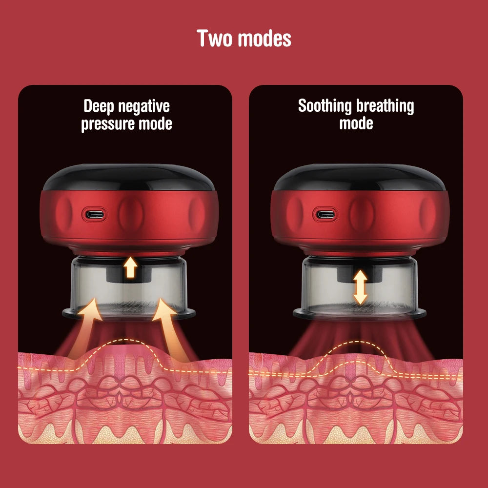 Smart Heat Cupping Massager